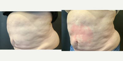 before and after image