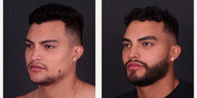 before and after image