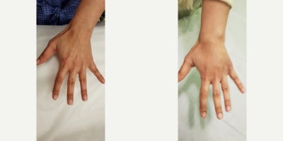 before and after image
