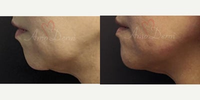 before and after image