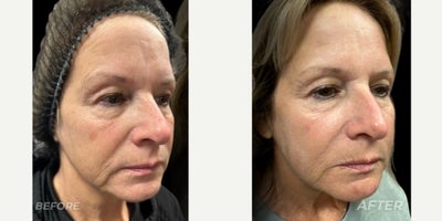 before and after image