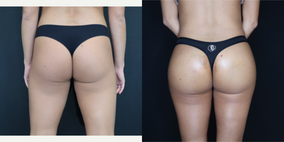 before and after image
