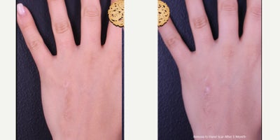 before and after image