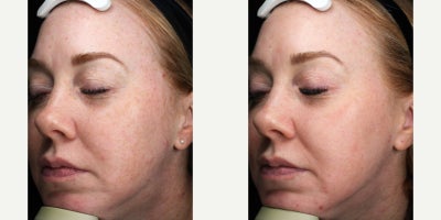 before and after image