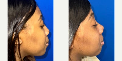 before and after image