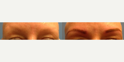 Microblading before and after photo