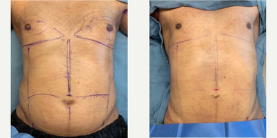before and after image