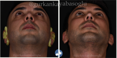 before and after image