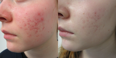 before and after image