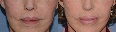 before and after image
