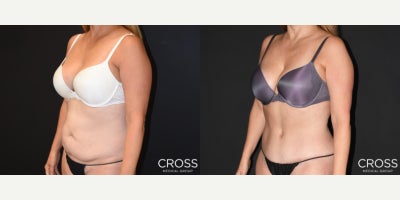 before and after image