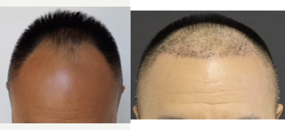before and after image