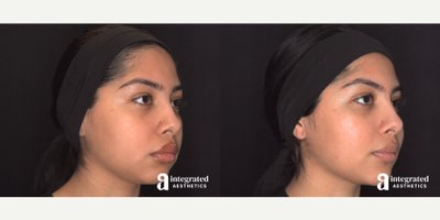 before and after image