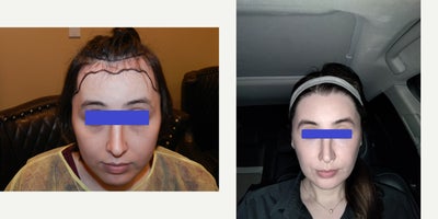 before and after image
