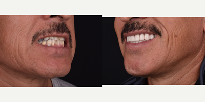 before and after image