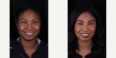 before and after image