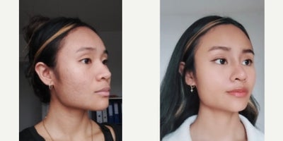 before and after image