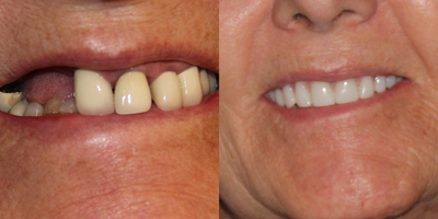 before and after image