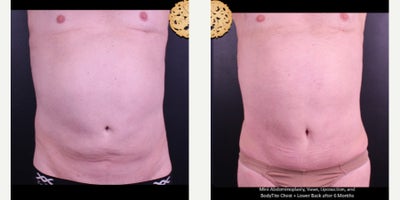 before and after image