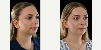 before and after image