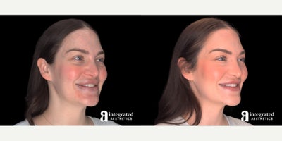 before and after image