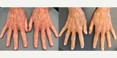 before and after image