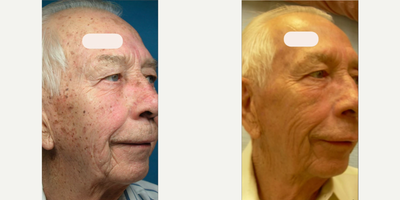 before and after image