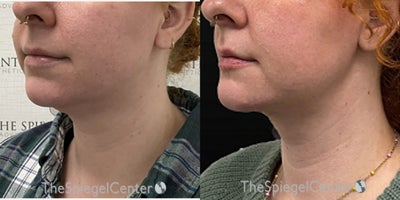 before and after image