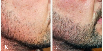 before and after image
