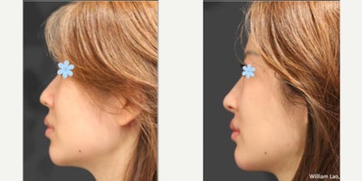 before and after image