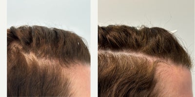 before and after image