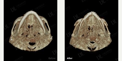 before and after image