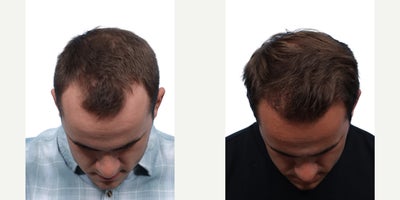 before and after image