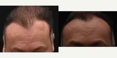 before and after image