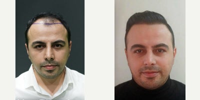 before and after image
