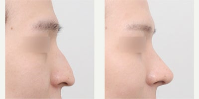 before and after image