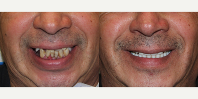 before and after image