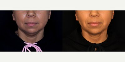 before and after image