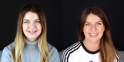 Invisalign before and after photo
