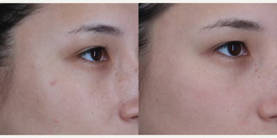 before and after image