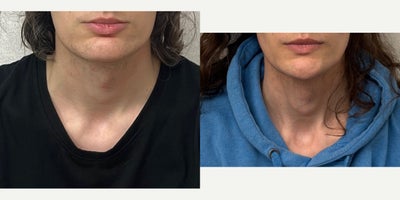 before and after image