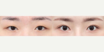 before and after image