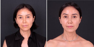 before and after image