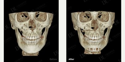 before and after image