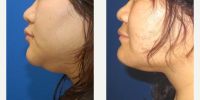 before and after image