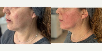 before and after image