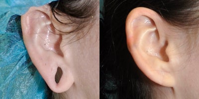 before and after image