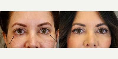 before and after image