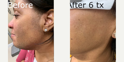before and after image