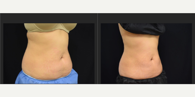 before and after image
